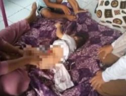 Balita Tiga Tahun di Jayakerta Tak Miliki Lubang Anus, Keluarga Butuh Bantuan Biaya Operasi